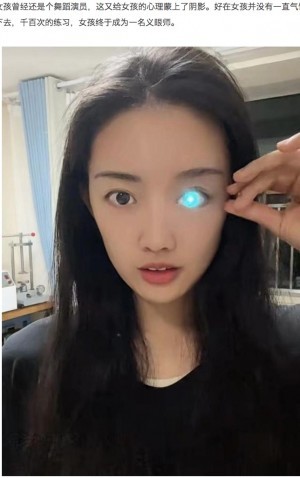 事故で片目を失った女性、自ら作った“光る義眼”で人気を博す（中国） - Techinsight japan - GREE ニュース